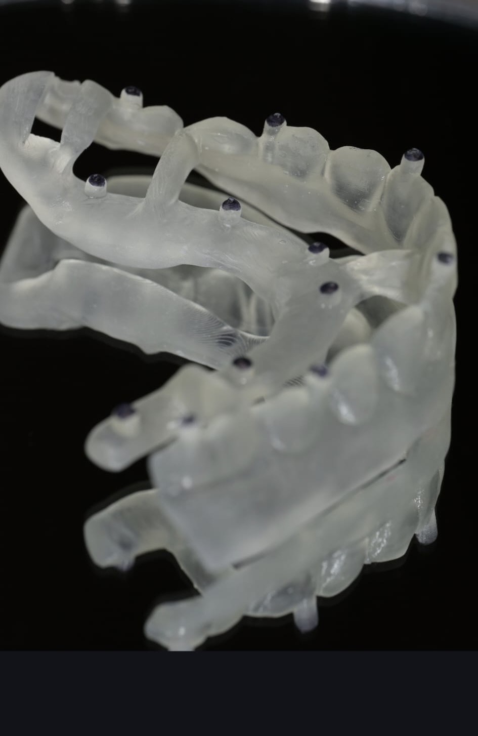 Digital dentistry workflow
